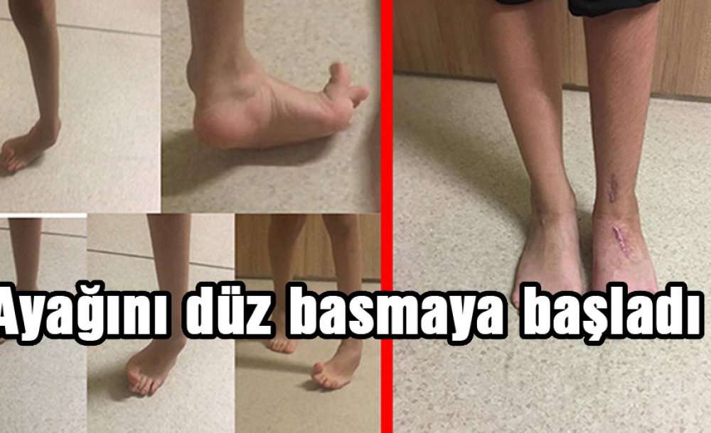 Ayağını Düz Basmaya Başladı